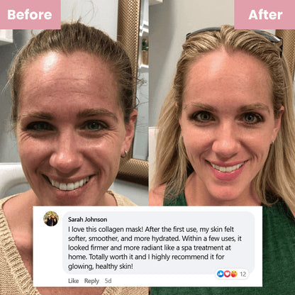 Mascarilla Facial Nocturna con Colágeno (N.º 1 Más Vendida)