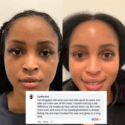 Mascarilla Facial Nocturna con Colágeno (N.º 1 Más Vendida)